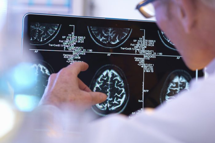 doctor pointing at brain mri images